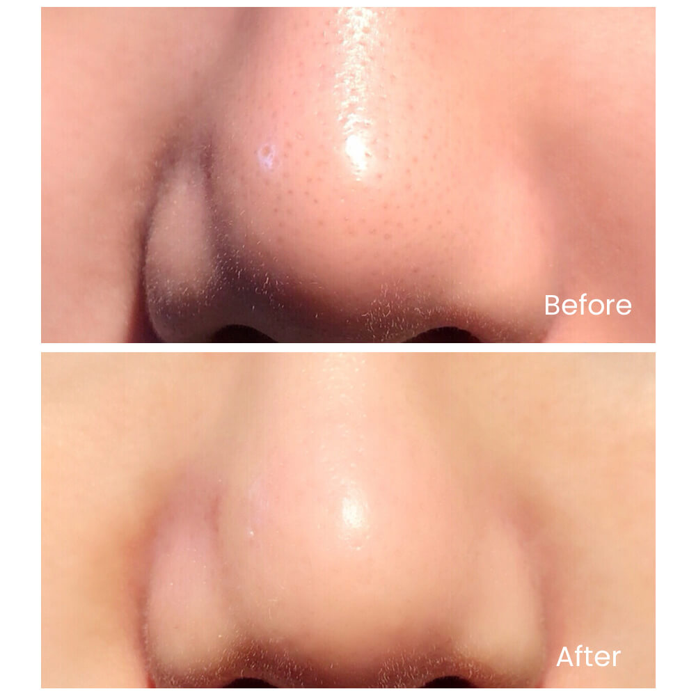 ULTRASONIC SCRUB DEVICE | TOUCHBeauty GLOW