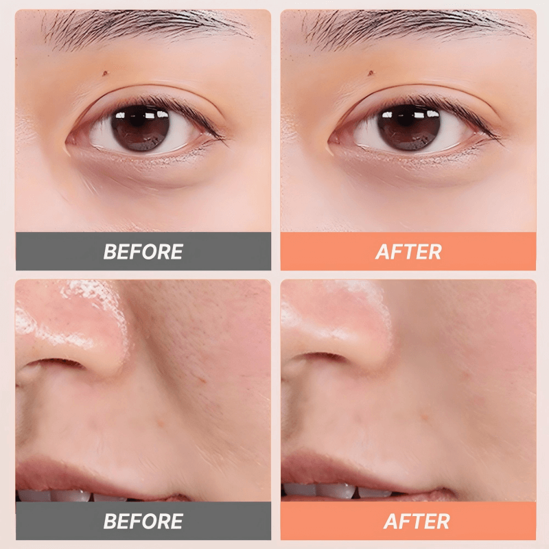 Lift2 Beauty Device – Multi - Dimensional Anti - Aging Technology - TOUCHBeauty