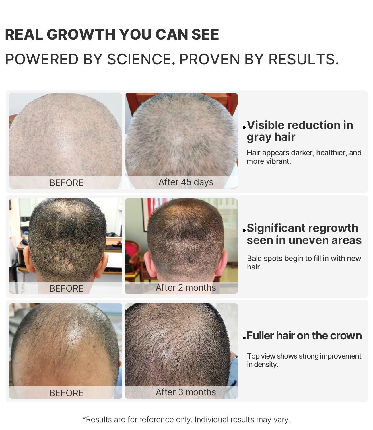 VITA Graphene Scalp Rejuvenating Helmet | Advanced Far - Infrared Scalp Therapy - TOUCHBeauty
