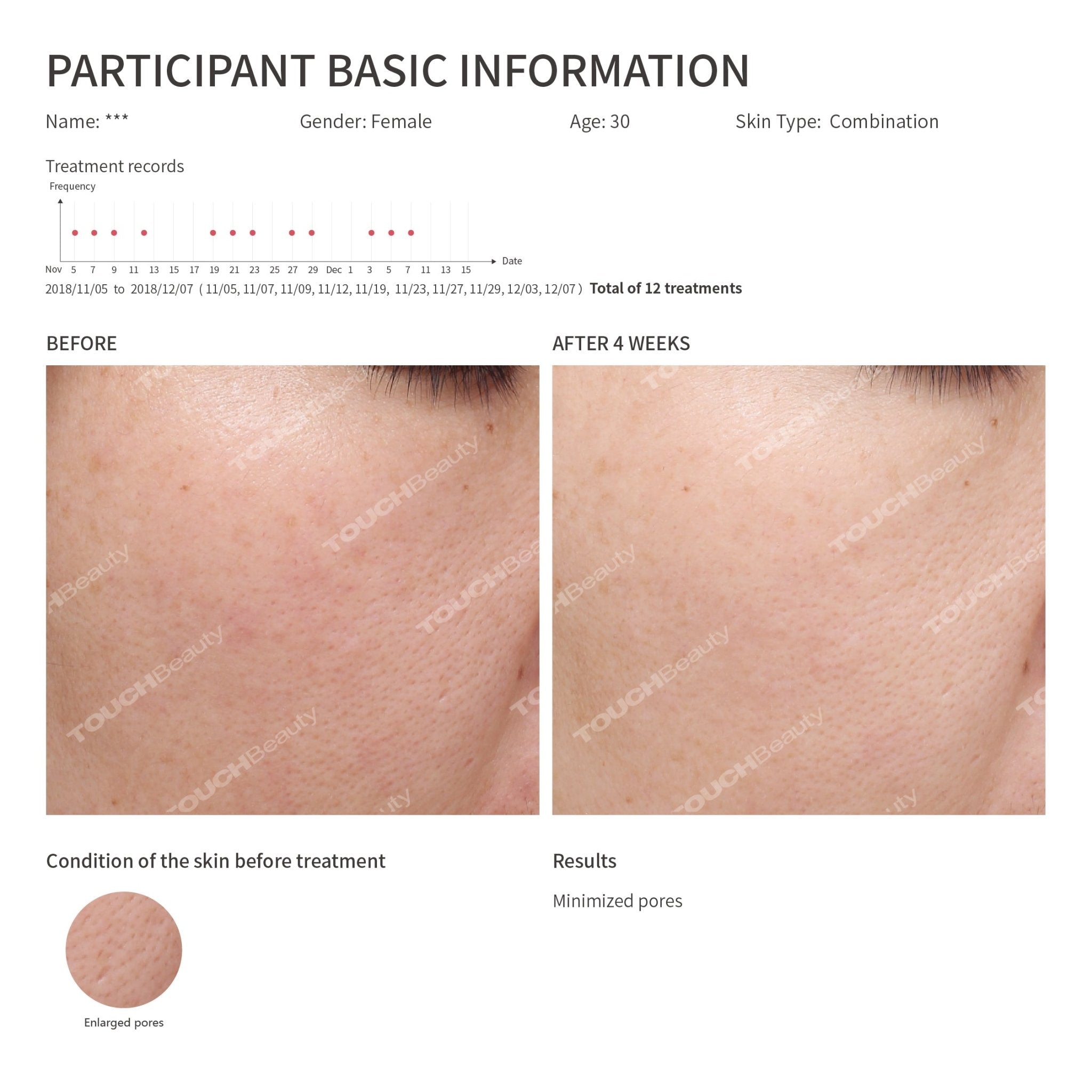 Hot/Cool Skin Device - TOUCHBeauty