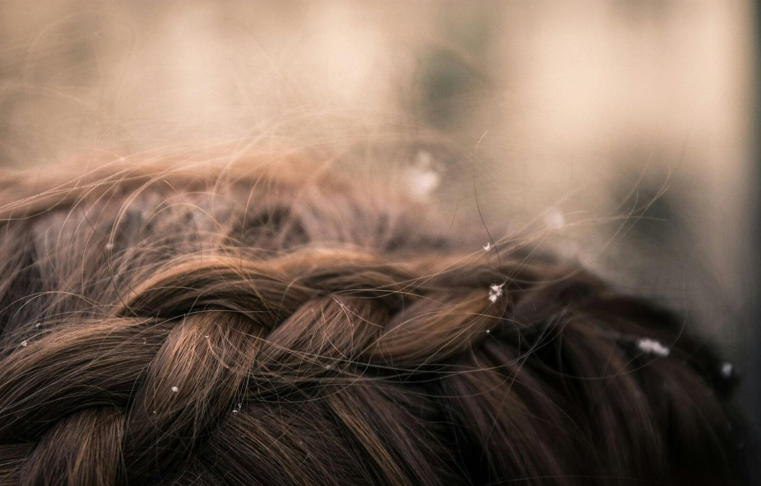 Dandruff vs. Dry Scalp: What’s the Difference—and How Do You Treat Each One Effectively?