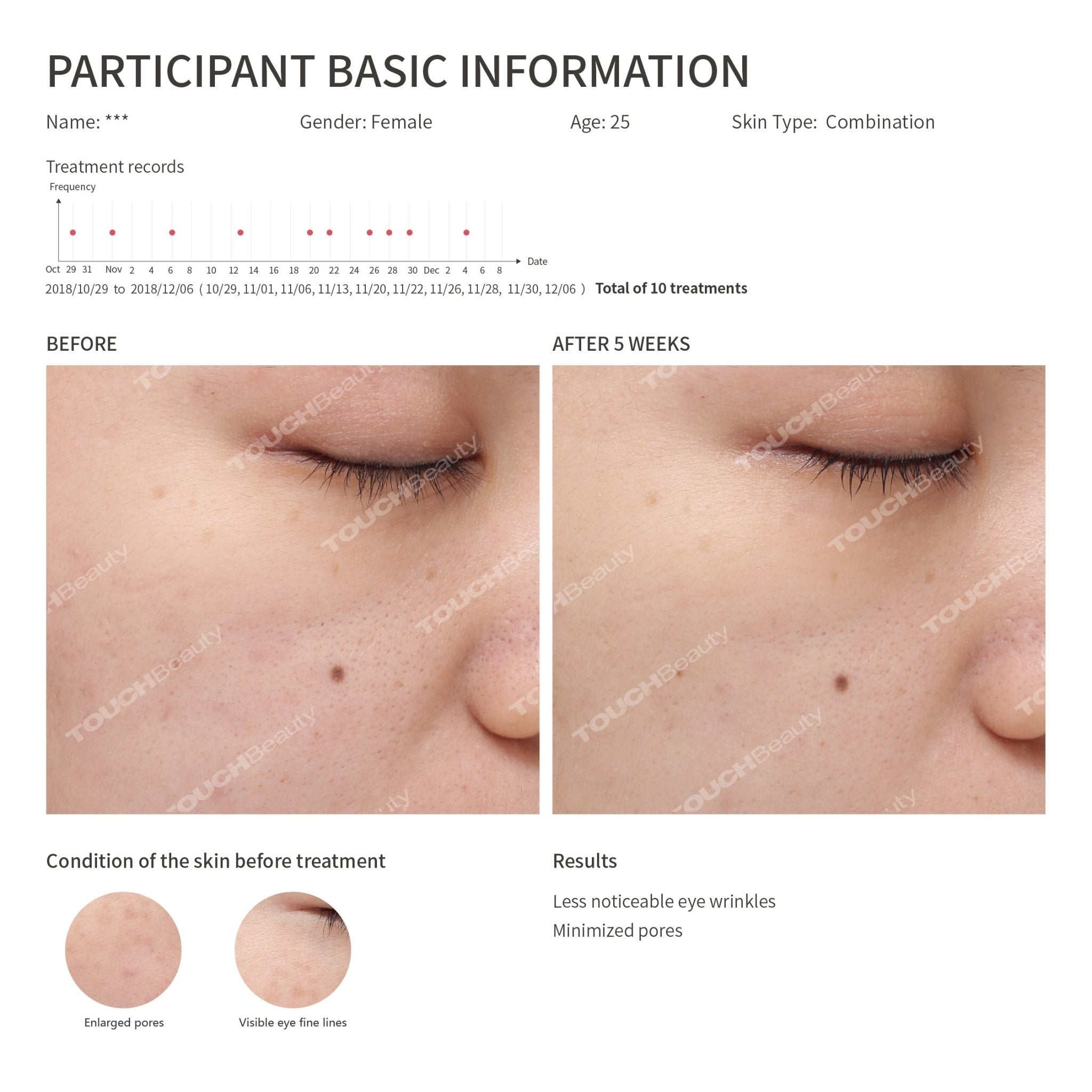 Hot/Cool Skin Device - TOUCHBeauty